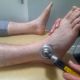 Laser Therapy being applied to an ankle